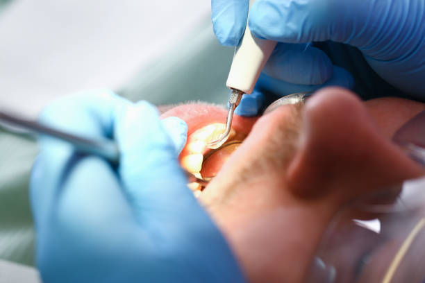  Chevy Chase, MD Emergency Dentist Pros