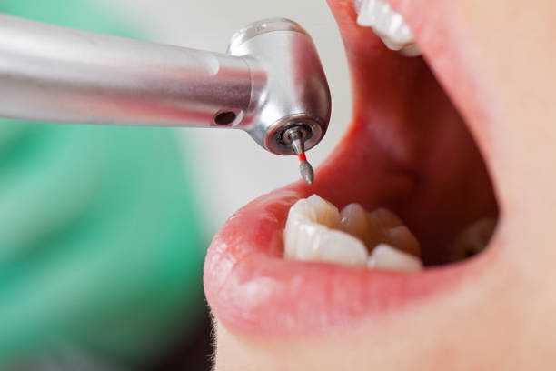 Best Orthodontic Emergency Dentist in Chevy Chase, MD